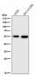Anti-Aromatase CYP19A1 Rabbit Monoclonal Antibody